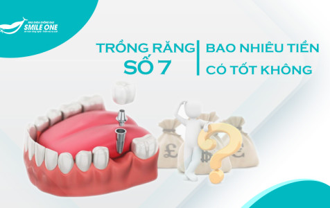 Trồng răng số 7 hết bao nhiêu tiền, loại nào tốt?